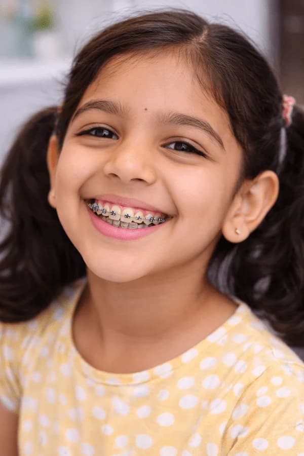 Early Braces Consultation